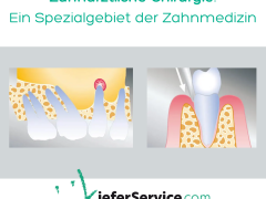 Zahnärztliche Chirurgie - Spezialgebiet der Zahnmedizin